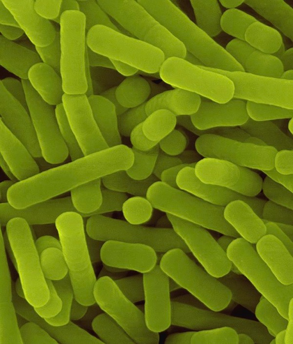 Gambar Jenis Bakteri Anaerob