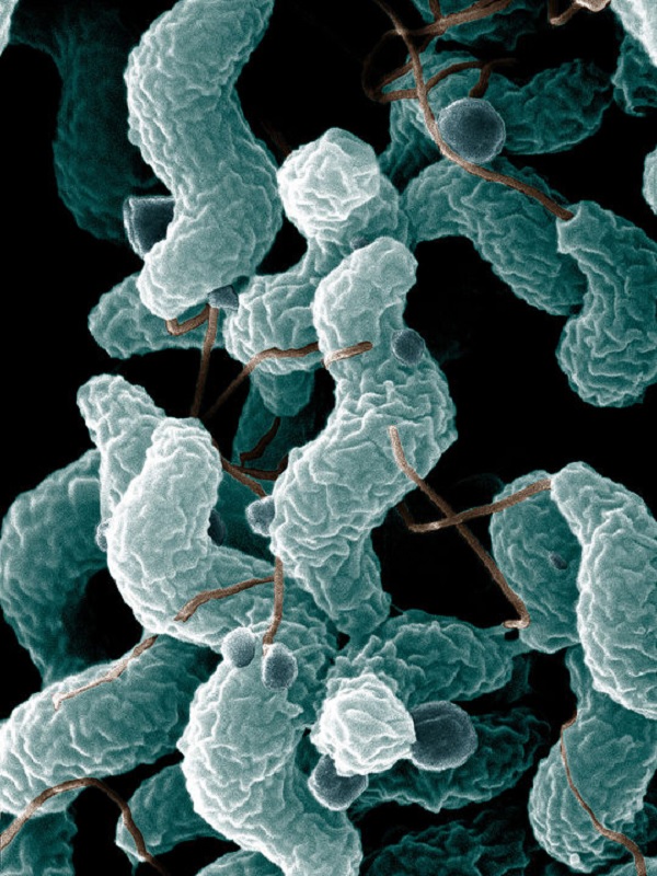 Gambar Jenis Bakteri Bentuk Spiral