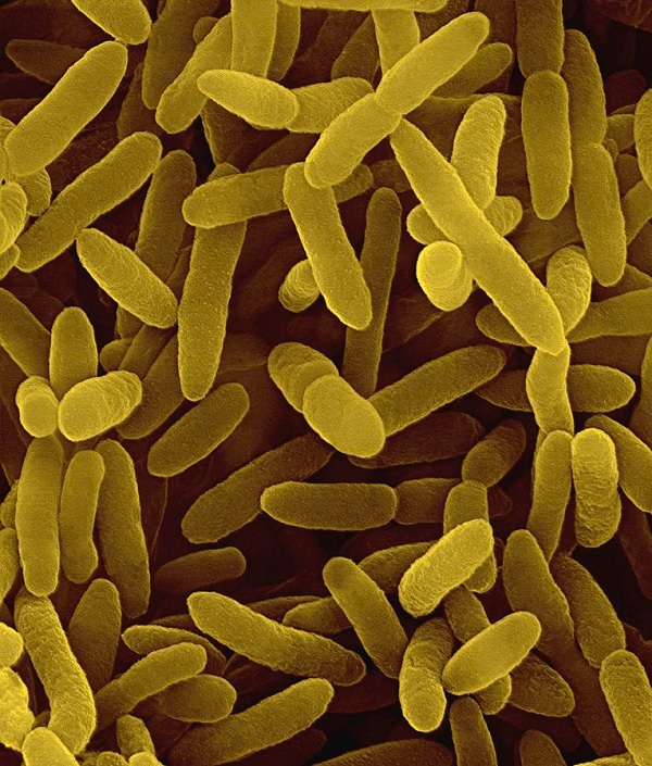 Contoh Jenis Bakteri Berflagel Lofotrik