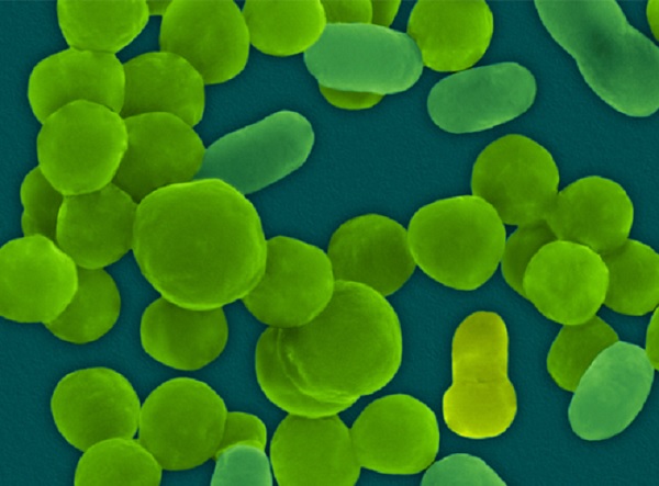 Gambar Jenis Bakteri Gram Negatif