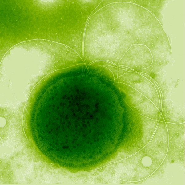 Gambar Jenis Bakteri Hipertermofil